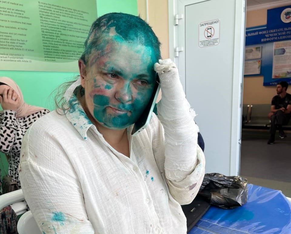 Избитой в Чечне журналистке Милашиной сломали пальцы, когда требовали у нее пароль от телефона — Собчак