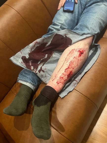 Navalny aide Leonid Volkov attacked in his home, maced with tear gas and struck with a hammer